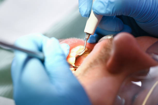 Best Emergency Treatment for Toothache in Monarch Mill, SC