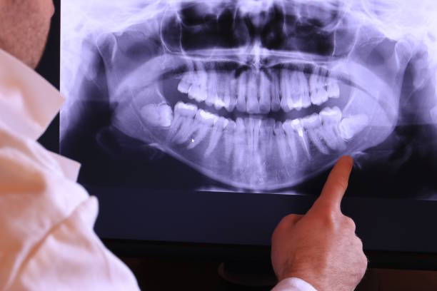 Best Emergency Treatment for Toothache in Monarch Mill, SC